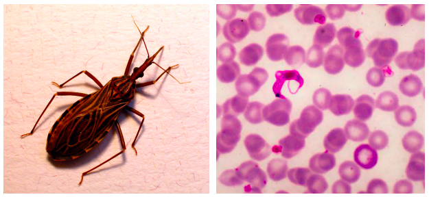 Imagenes de vincucha y del parásito T. cruzi en sangre