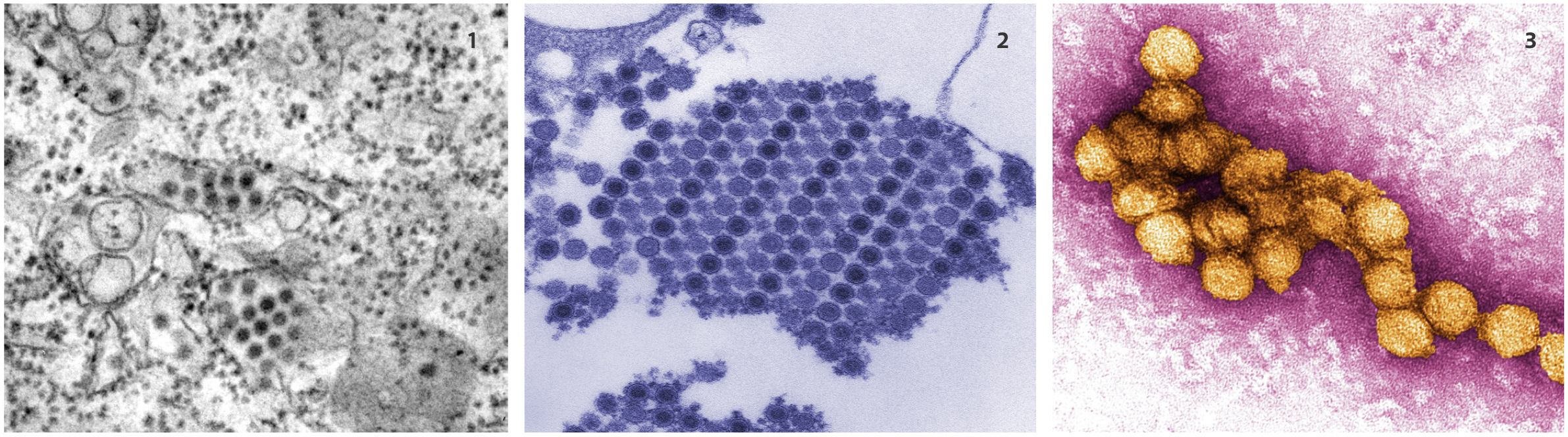 These pictures show the Dengue, Chikungunya, and West Nile viruses.