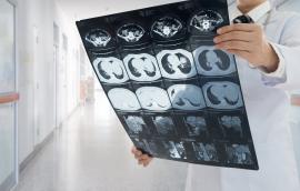 Doctor reviews large sheet of imaging output in a clinical hallway
