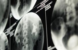 Kidney imaging