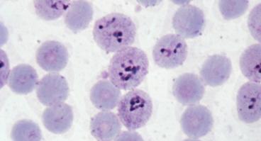 Micrograph of Malaria in Human Cells
