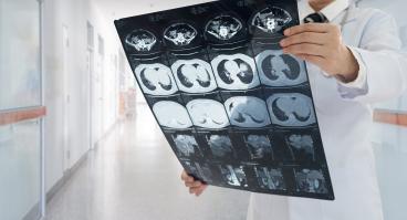 Doctor reviews large sheet of imaging output in a clinical hallway