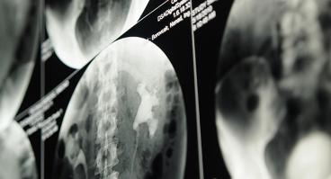 Kidney imaging