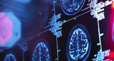 Brain + Imaging
