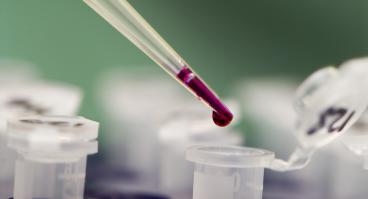 Lab sample pipette