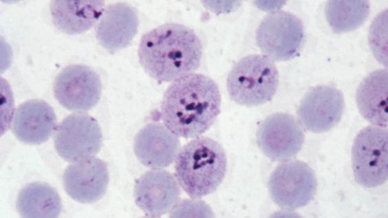 Micrograph of Malaria in Human Cells