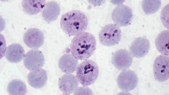 Micrograph of Malaria in Human Cells