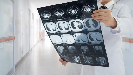 Doctor reviews large sheet of imaging output in a clinical hallway
