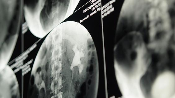 Kidney imaging
