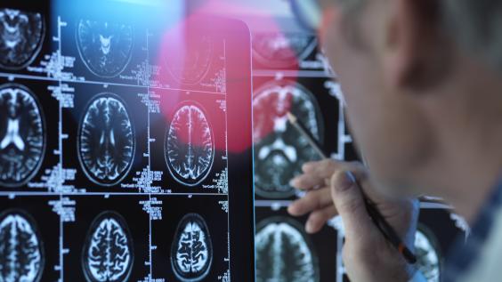 Brain imaging