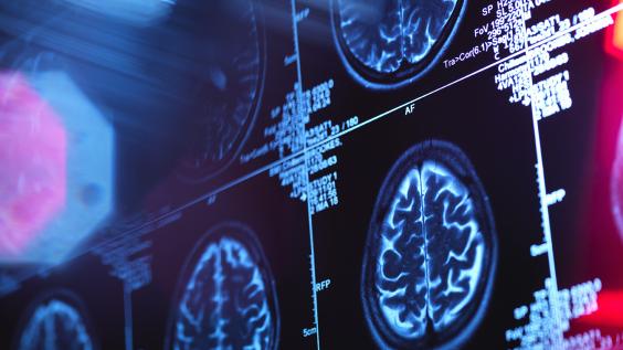 Brain + Imaging