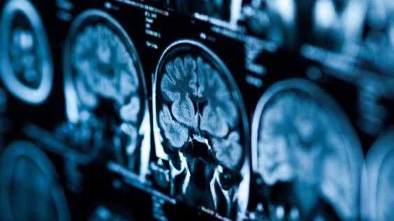 Brain + xray