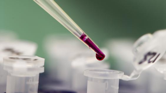 Lab sample pipette