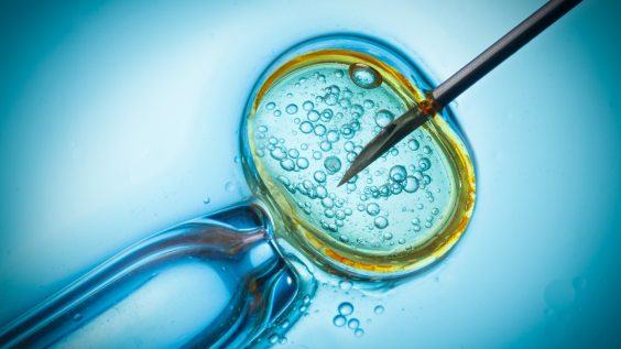 In vitro fertilization image