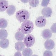 Micrograph of Malaria in Human Cells