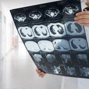 Doctor reviews large sheet of imaging output in a clinical hallway