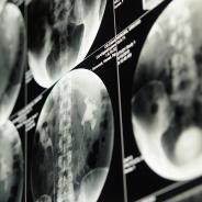 Kidney imaging