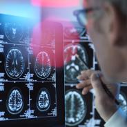 Brain imaging