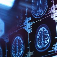Brain + Imaging
