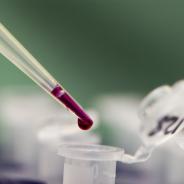 Lab sample pipette