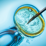 In vitro fertilization image