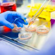 Gloved hand with pipette in lab setting