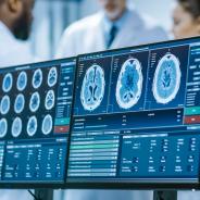 Computer Screen Showing MRI, CT Image Scan of the Brain. In the Background Meeting of the Team of Medical Scientists in the Brain Research Laboratory.