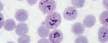 Micrograph of Malaria in Human Cells