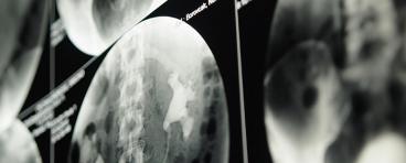 Kidney imaging