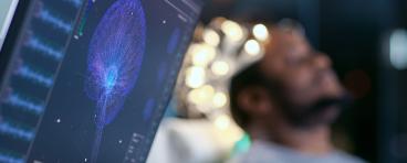 Brain