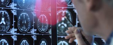 Brain imaging