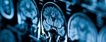 Brain + xray
